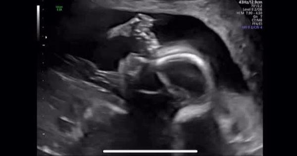 4岁韩女星惊喜宣布「怀孕了」夫妇天天祈祷PG麻将胡了网站入口嫁小6岁尪2年！4